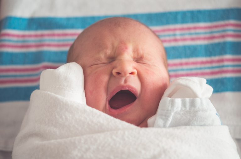 Hur är gulsot diagnostiserat hos en bebis?